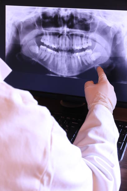 Best Emergency Tooth Extraction in Chariton, IA