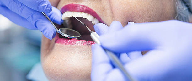 Best Emergency Wisdom Teeth Removal in Chariton, IA