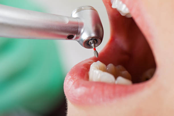 Best Emergency Dental Care for Trauma or Injury in Chariton, IA